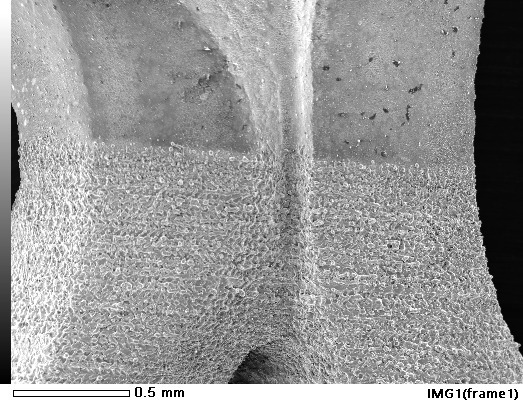 Laser recovery of iridium Laser recovery of iridium
